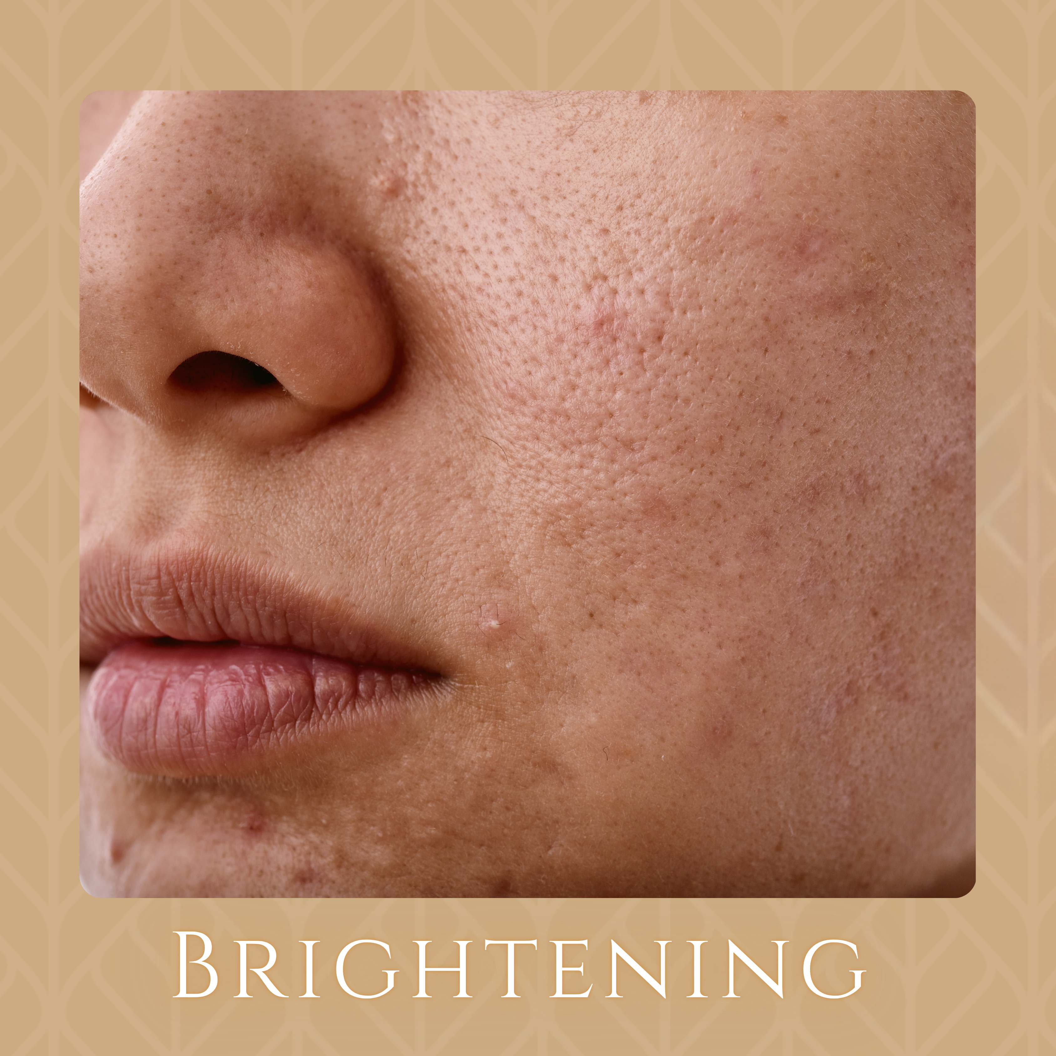 Brightening
