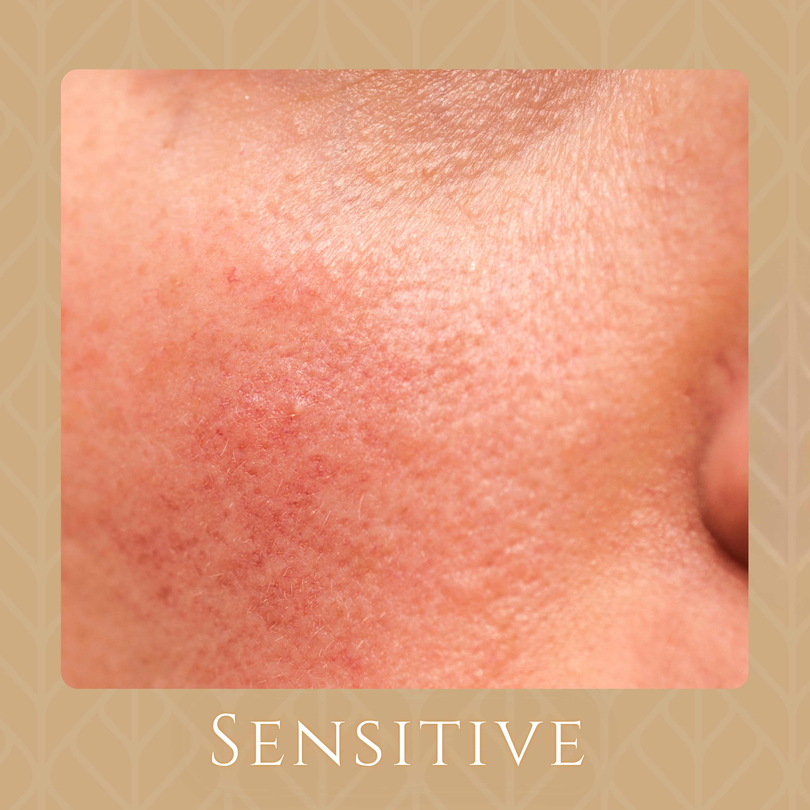 Sensitive