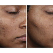 OURSELF COMPLEXION BRIGHTENING SERUM