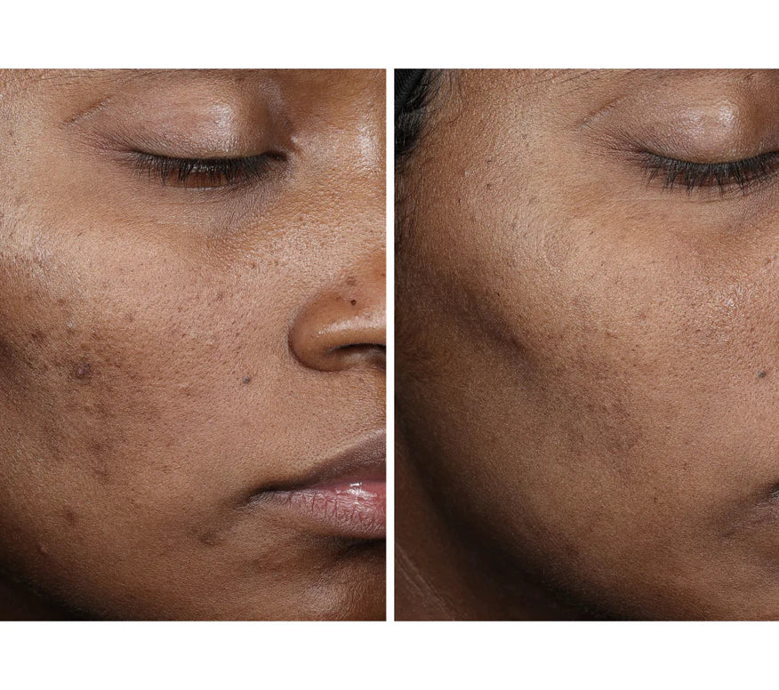 OURSELF COMPLEXION BRIGHTENING SERUM