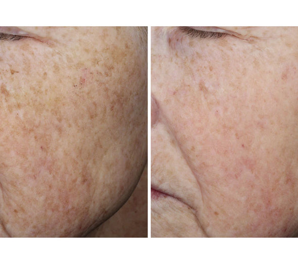 OURSELF COMPLEXION BRIGHTENING SERUM